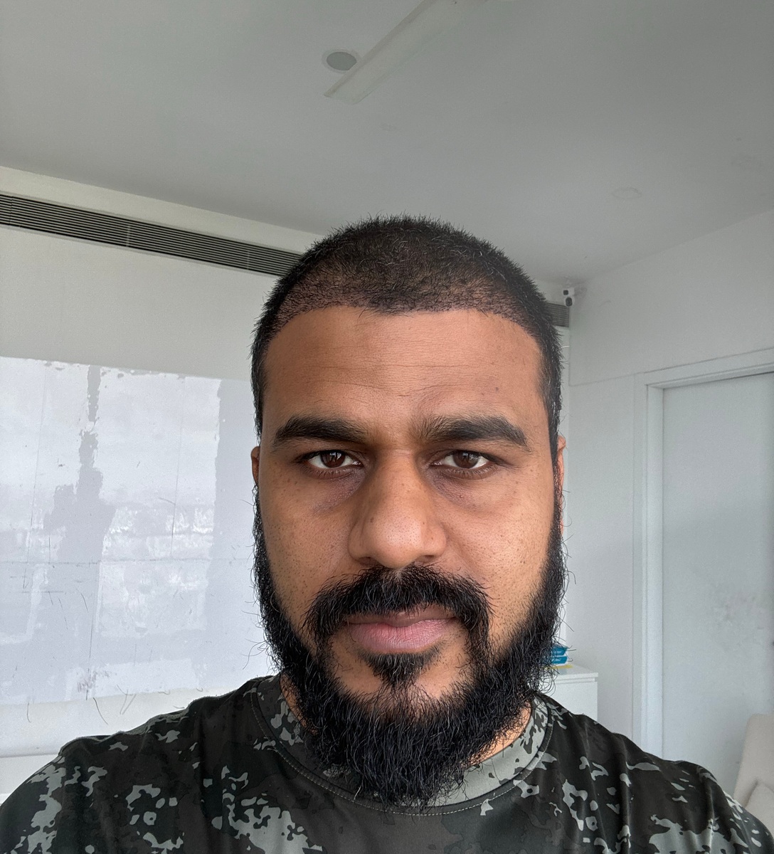 Vikrant's hairline photograph from Day 26, 14 Aug 2026.