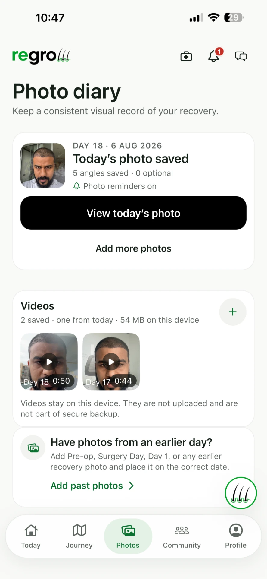 Regrow Photo diary screen showing today's photo saved